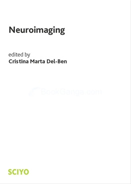 Neuroimaging
